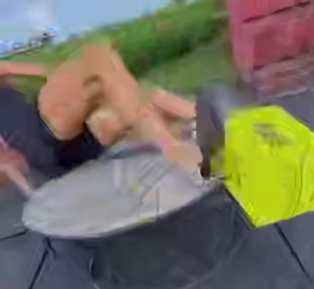 Краснодарская модель сломала руку, повторяя опасный тренд из соцсетей