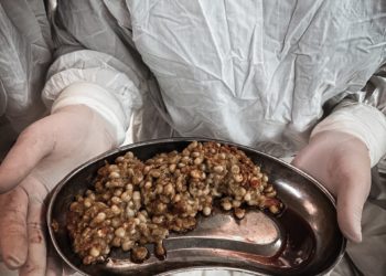 В Краснодаре хирурги извлекли из пациентки ком непереваренной кукурузы