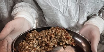 В Краснодаре хирурги извлекли из пациентки ком непереваренной кукурузы