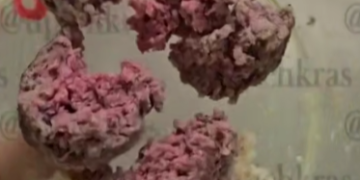 В краснодарской больнице пациентов с язвой «лечат» сырыми котлетами