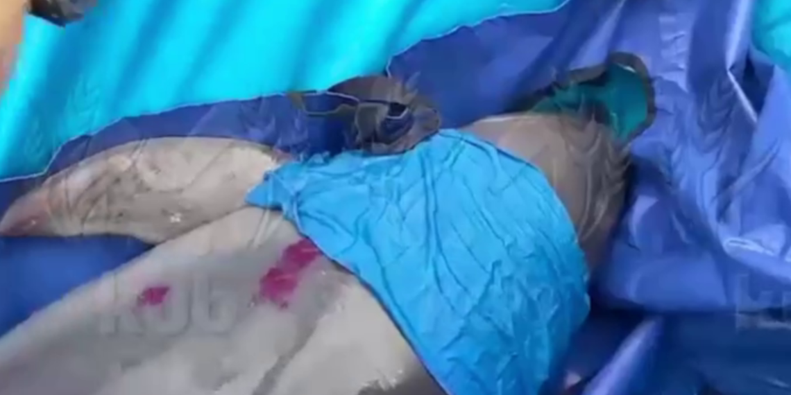 Спасенного в реке Бейсуг многострадального дельфина выпустили в Черное море