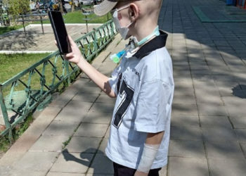 Мальчик из Сочи, пострадавший от укусов хаски, начнет обучение в середине сентября