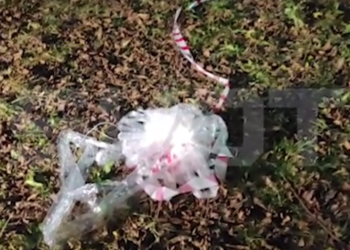 В Красногорске ребенку разорвало руку взрывом: он поднял десятирублёвку