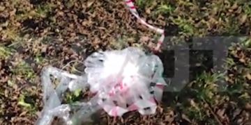 В Красногорске ребенку разорвало руку взрывом: он поднял десятирублёвку