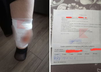 Бродячая собака покусала пенсионерку в Краснодаре