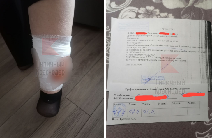 Бродячая собака покусала пенсионерку в Краснодаре