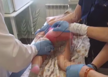 За 28 тысяч рублей в месяц ребёнок получил ожог ягодиц в частном саду Сочи