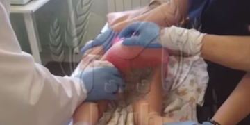 За 28 тысяч рублей в месяц ребёнок получил ожог ягодиц в частном саду Сочи