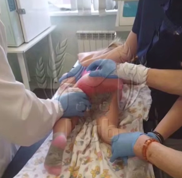 За 28 тысяч рублей в месяц ребёнок получил ожог ягодиц в частном саду Сочи