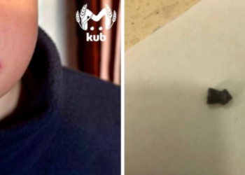 Ребенок в Туапсе получил пулевое ранение в лицо во время просмотра TikTok