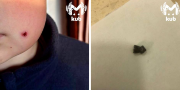 Ребенок в Туапсе получил пулевое ранение в лицо во время просмотра TikTok