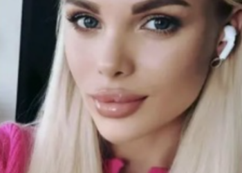 Найденной в Москве модели с Кубани провели операцию по трепанации черепа