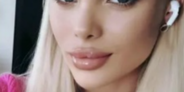 Найденной в Москве модели с Кубани провели операцию по трепанации черепа