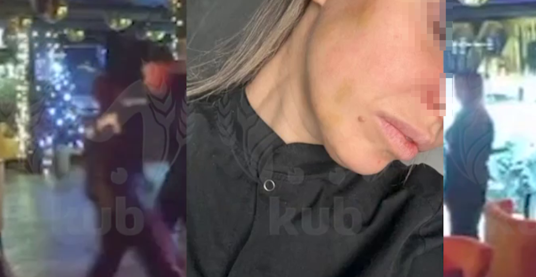 Не давали пить и курить: в Адлере стажер-кальянщик избил жену владельца клуба