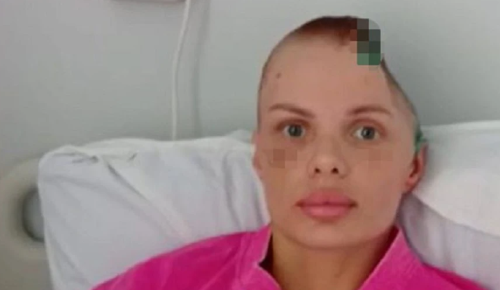 Модель с Кубани с раскроенным черепом сделала первое страшное признание