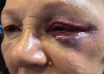 В Краснодаре шестой день ищут мужчину, сломавшего лицо пожилой консьержке