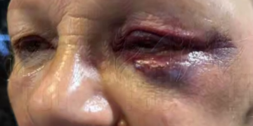 В Краснодаре шестой день ищут мужчину, сломавшего лицо пожилой консьержке