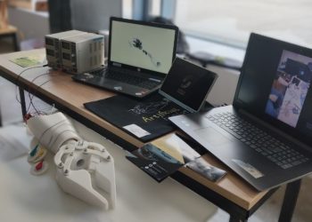 Протез-клешня: студент из Краснодара победил с идеей «шкафа для рук»