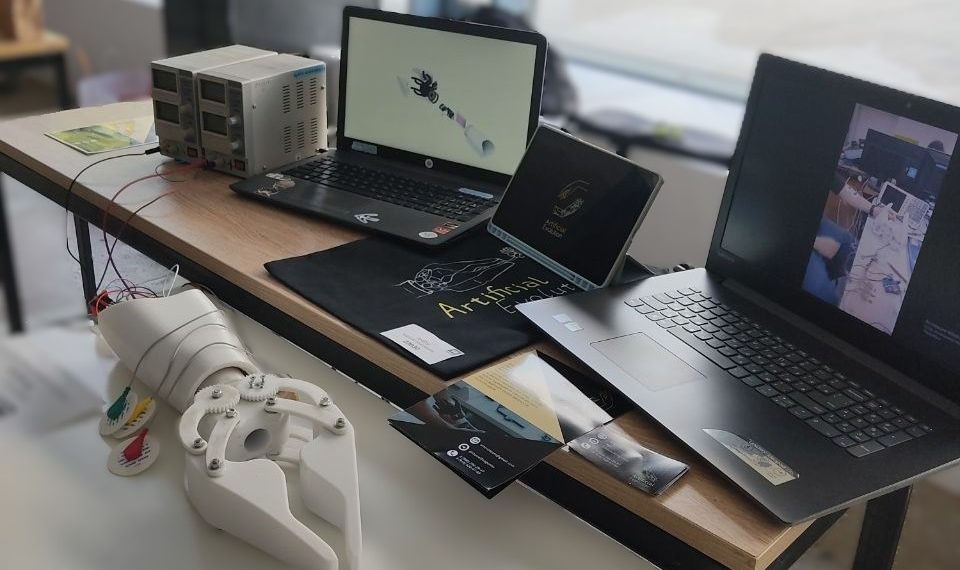 Протез-клешня: студент из Краснодара победил с идеей «шкафа для рук»