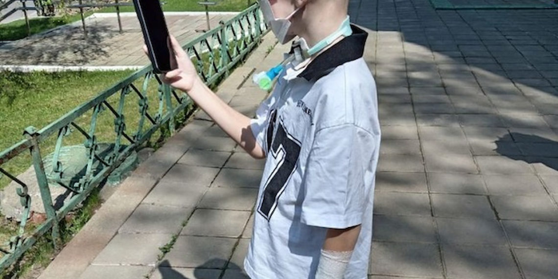 Сочинскому мальчику после нападения хаски вернут возможность дышать без трубки