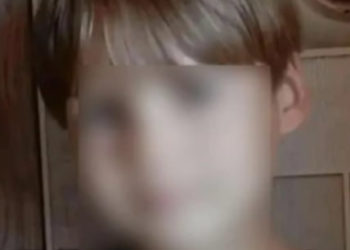 Стая питбулей сняла скальп с 12-летнего мальчика на Кубани