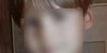 Стая питбулей сняла скальп с 12-летнего мальчика на Кубани