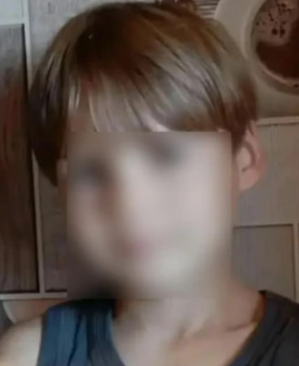 Стая питбулей сняла скальп с 12-летнего мальчика на Кубани